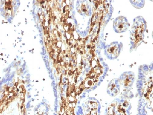 IHC-P - Anti-S100A4 Antibody AH13493-20